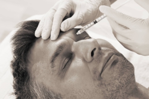 Behandlung von Mimikfalten in der oberen Gesichtshälfte mittels Botulinumtoxin / Botox in Lindau am Bodensee