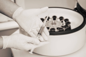 Vampirlifting PRP Plasmalifting Beschreibung: Verbesserung der Hautstruktur, Behandlung von Narben und Falten mittels Plasmalift , auch PRP, Eigenblutplasma, Vampirlifting genannt. Natürlich und ohne Einsatz von Fremdmaterialien in Lindau am Bodensee